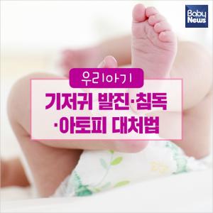 우리아기 기저귀 발진·침독·아토피 대처법