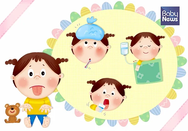 수족구병은 전염되기 때문에 아이가 이 병에 걸리면 며칠간 다른 아이와의 접촉을 피해 격리할 필요가 있습니다.?ⓒ베이비뉴스