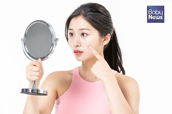 자궁에 찬 기운이 많고 어혈이 생성되어 있으면 기미나 여드름이 발생하기 쉽습니다. ⓒ베이비뉴스