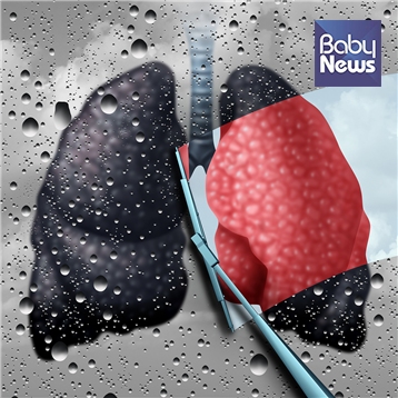 호흡기질환을 만성적으로 가지고 있는 환자의 경우에는 전염성 호흡기질환에 대한 고위험군이 될 수 있다. Ⓒ윤제한의원