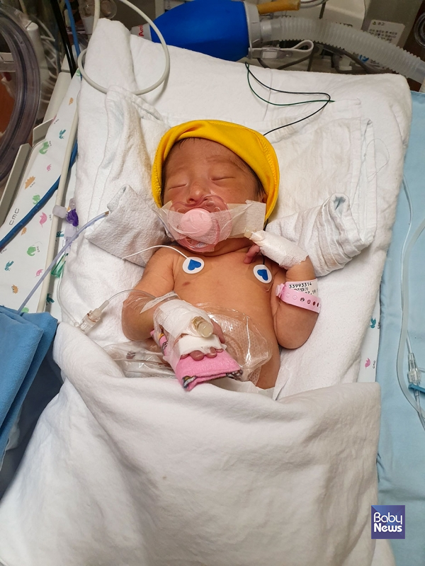 루나는 태어난 지 3일 만에 큰 수술을 받아야만 했다. 사진은 수술 후 중환자실에서 치료를 받고 있는 모습. ⓒ이상주