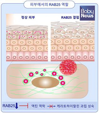 피부에서의 RAB25 단백질 역할. ⓒ세브란스병원